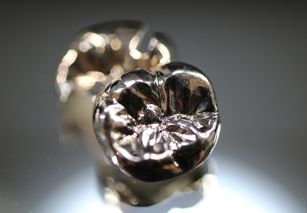 金銀パラジウム合金(奥歯のみ)